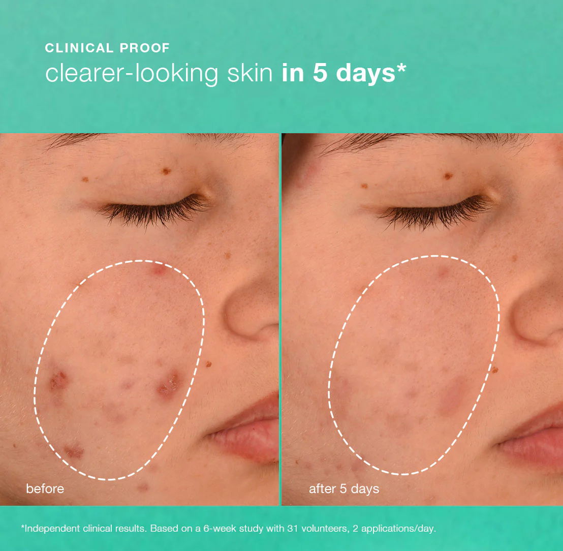 Breakout Biotic Moisturiser - Image 3