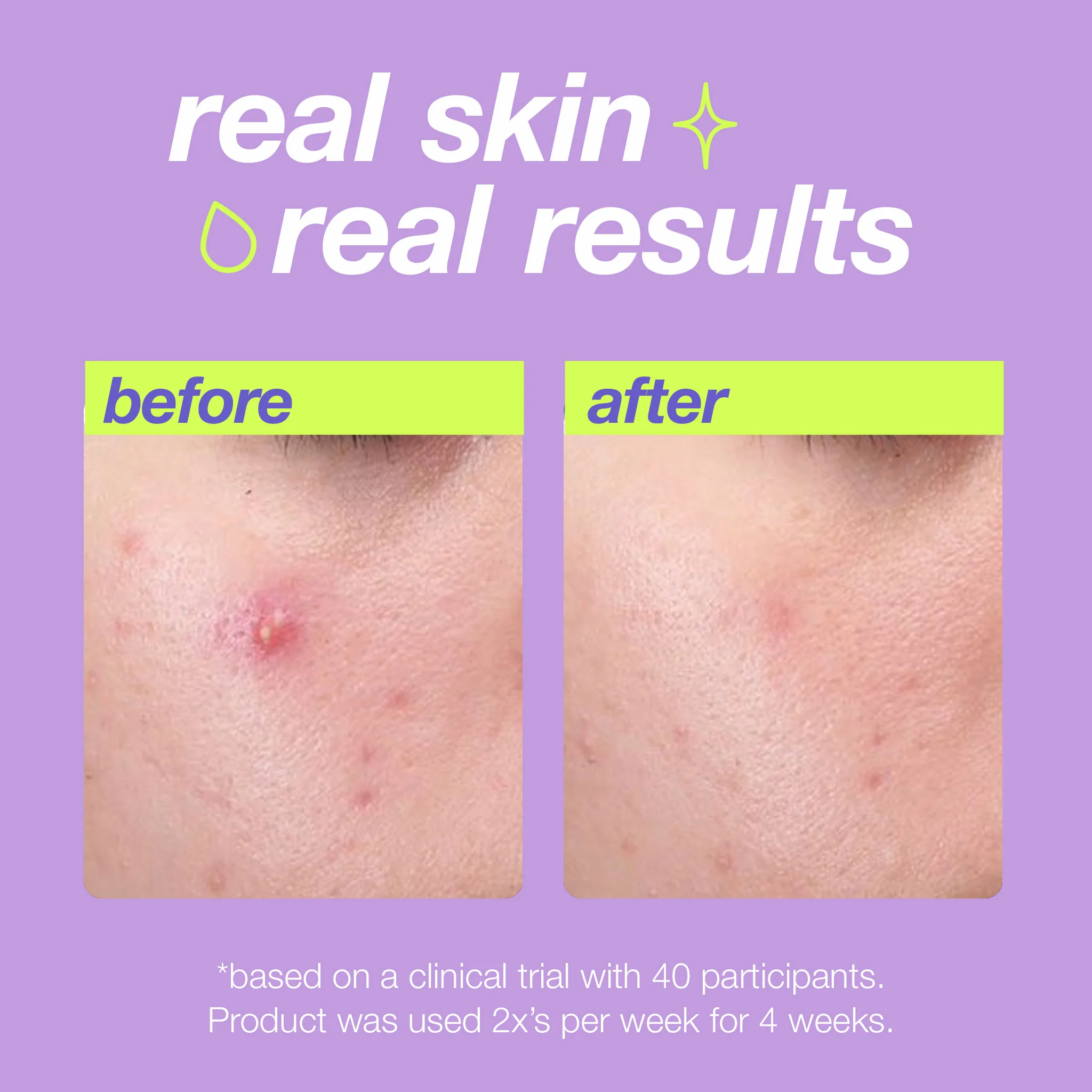 Breakout Clearing Liquid Peel - Image 8