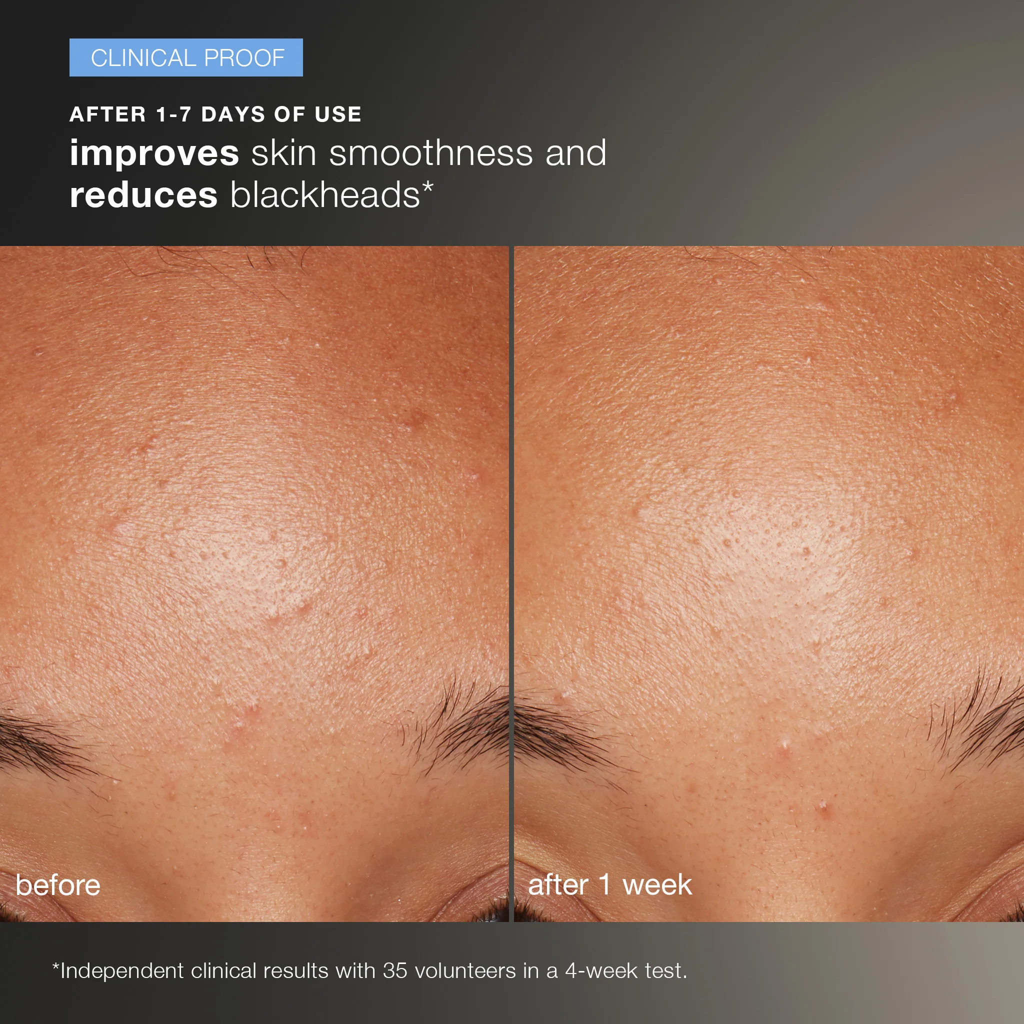 Daily Microfoliant Exfoliator Kit - Image 4