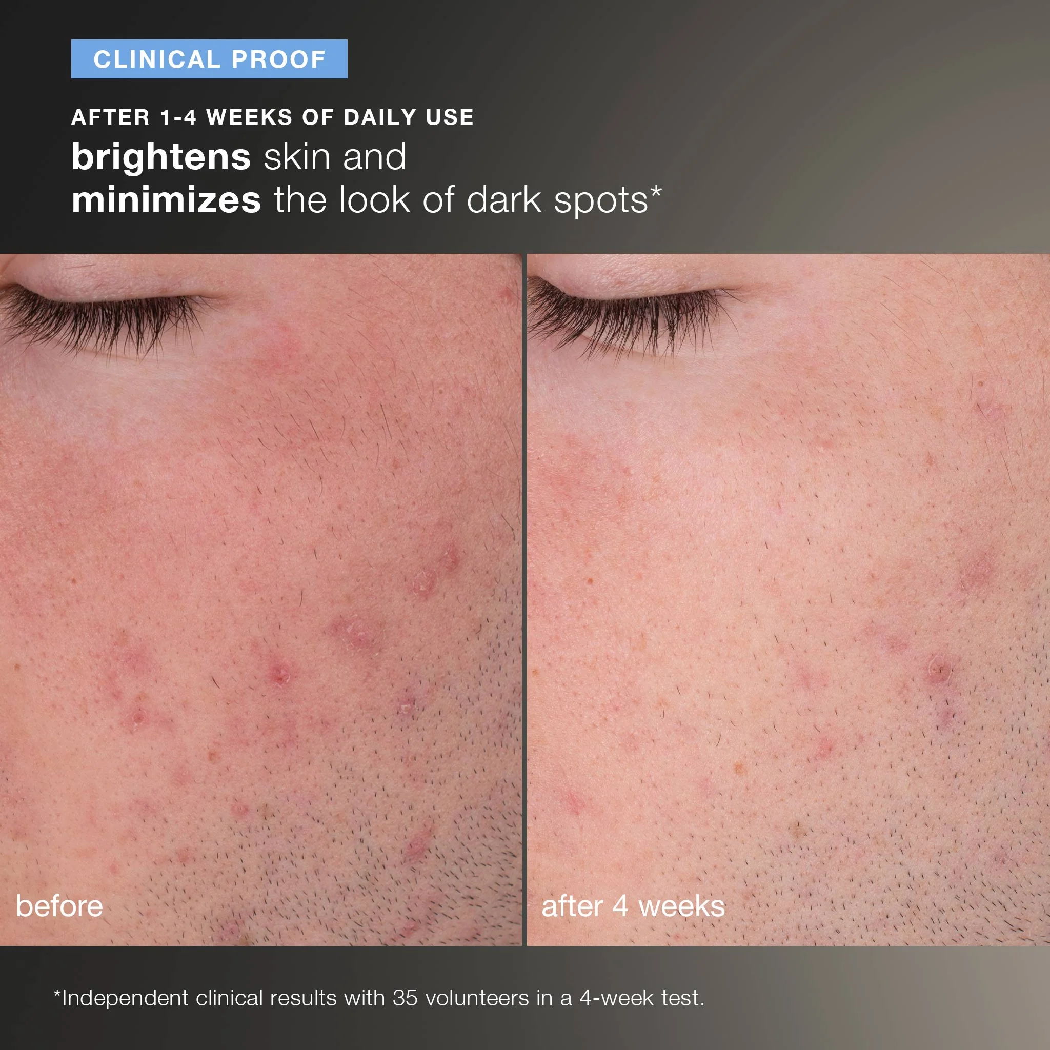Daily Microfoliant Exfoliator Kit - Image 7