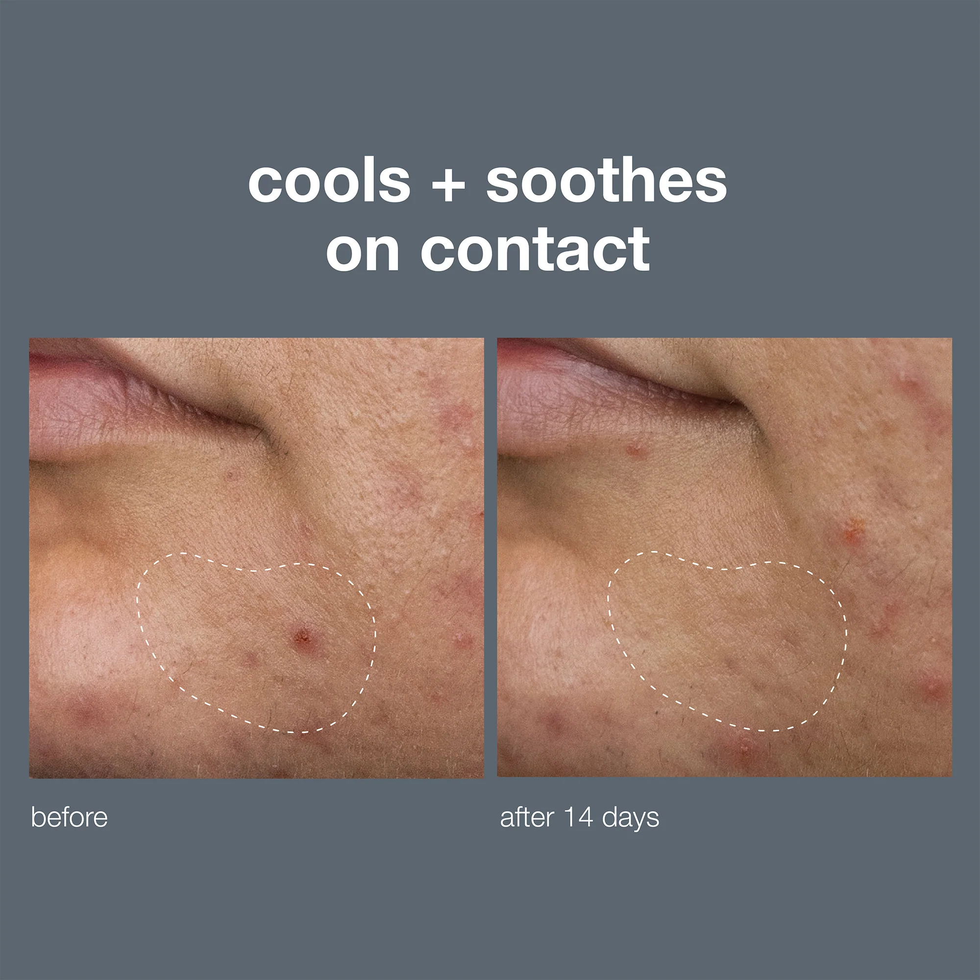 Deep Breakout Liquid Patch - Image 6