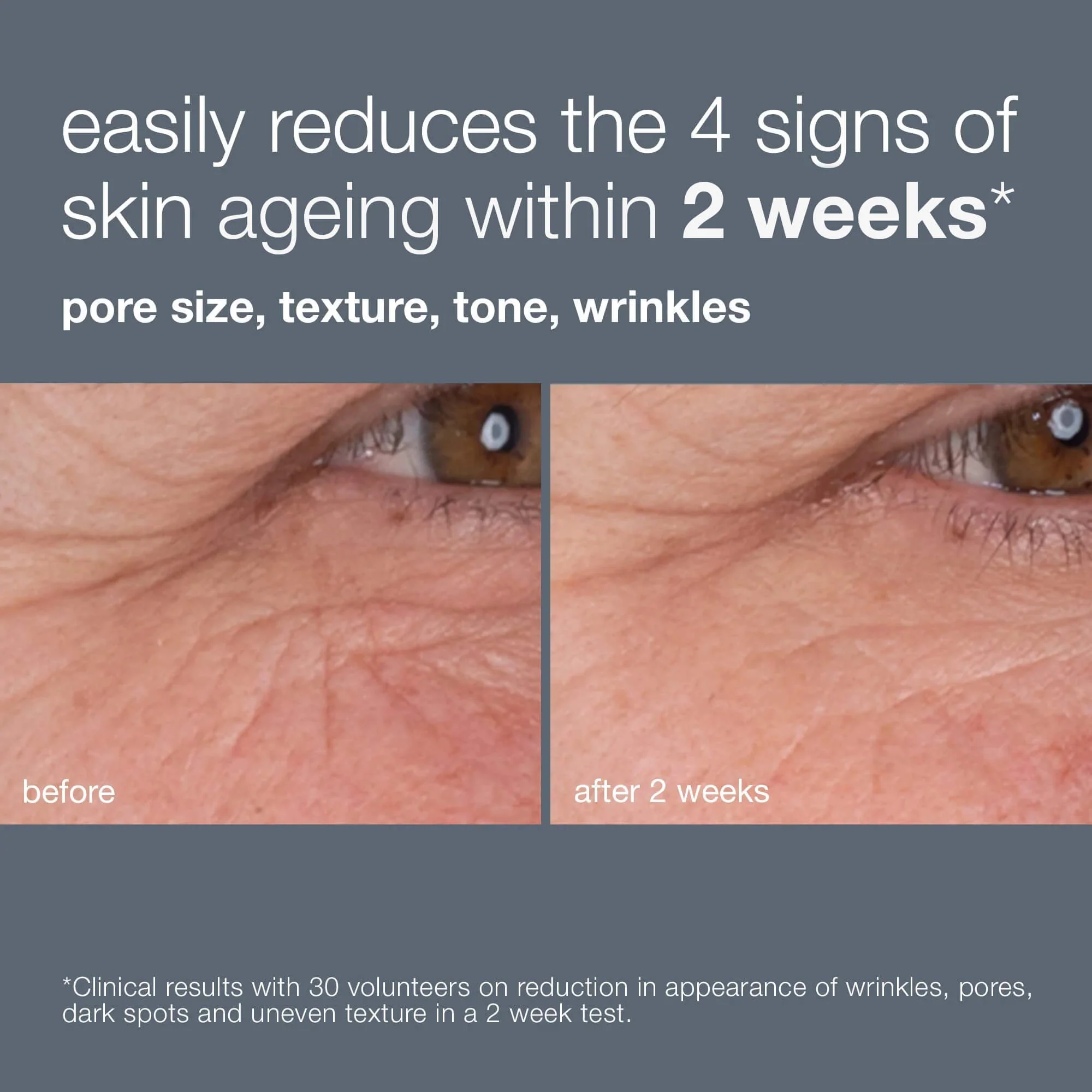 dynamic skin retinol serum travel size - Image 9