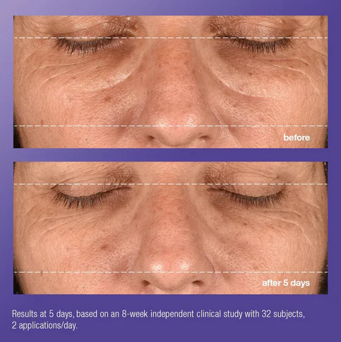 phyto nature e² regenerating daily exosome leave-on treatment - Image 7