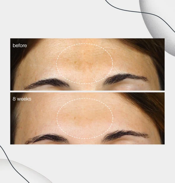 powerbright dark spot serum - Image 5