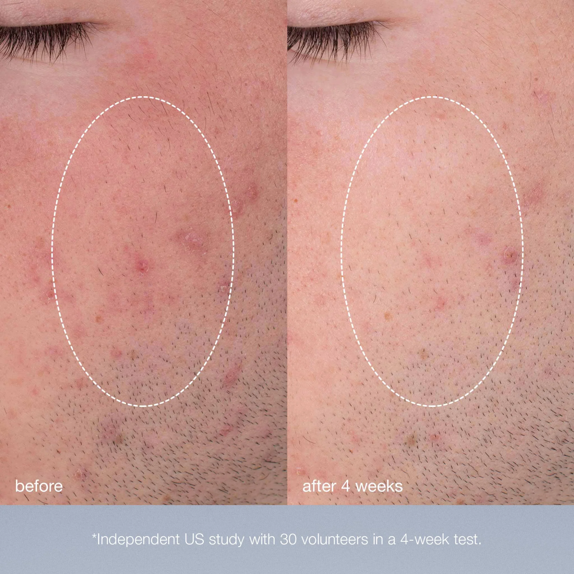 smooth + bank routine - Image 14