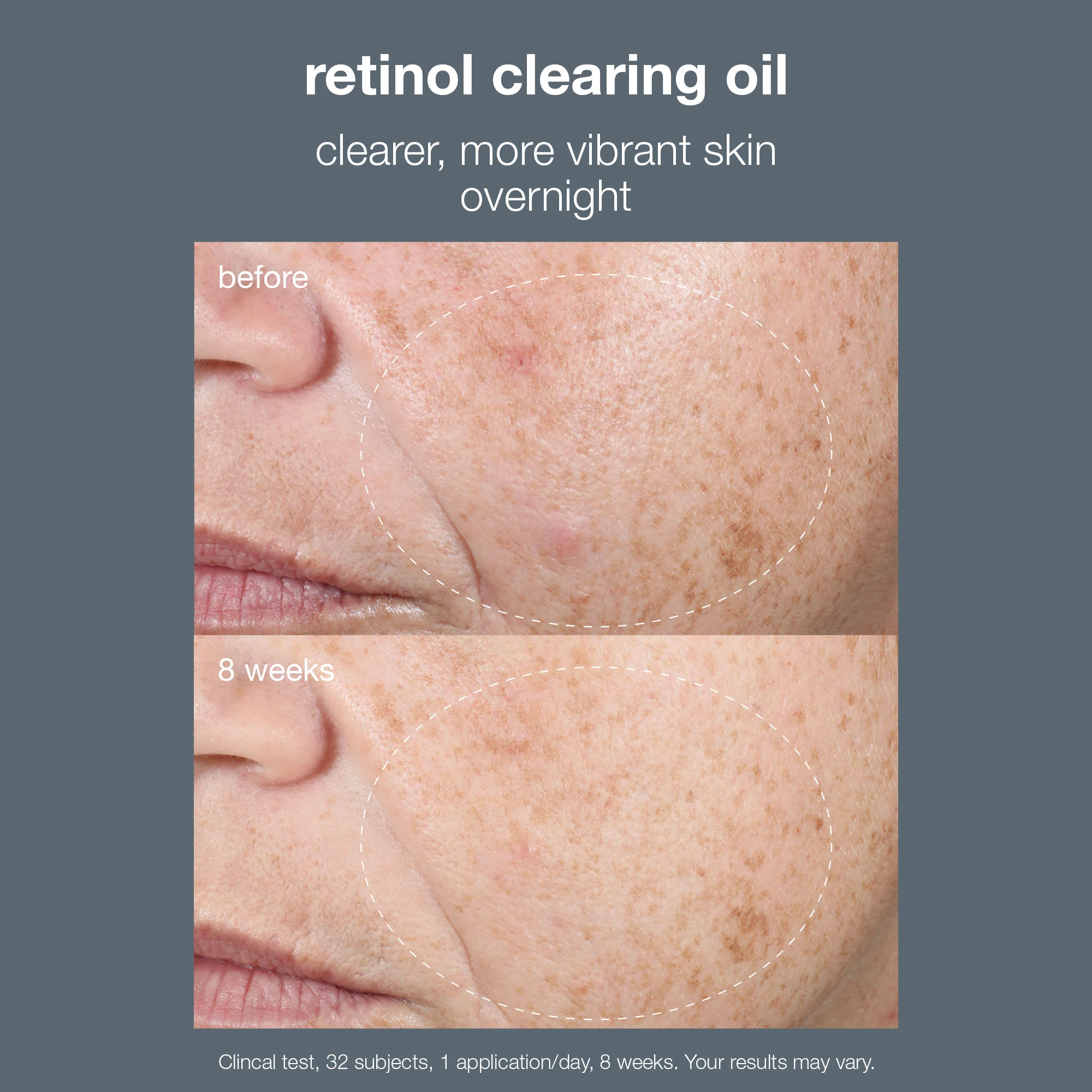 retinol clearing oil - Image 3