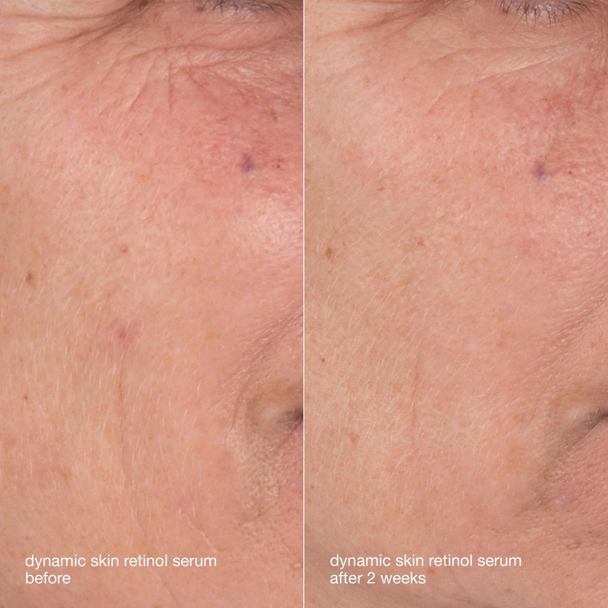 skin aging solutions kit - Image 4