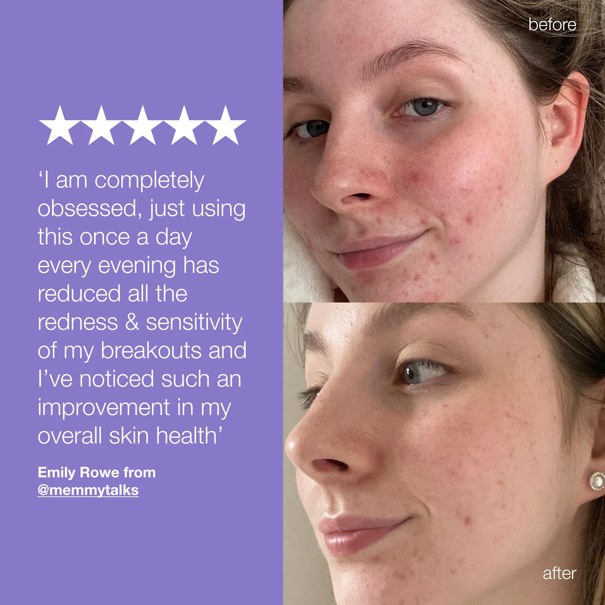stabilizing repair cream + ultracalming cleanser - Image 3