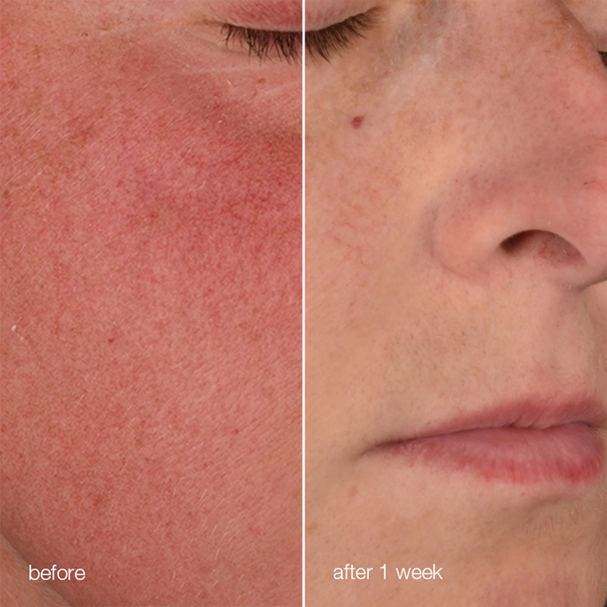 stabilizing repair cream + ultracalming cleanser - Image 6